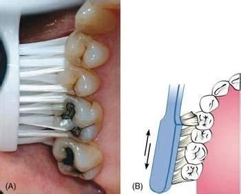 Tooth Brushing Methods | Bass & Modified Stillman Technique | Dentistry