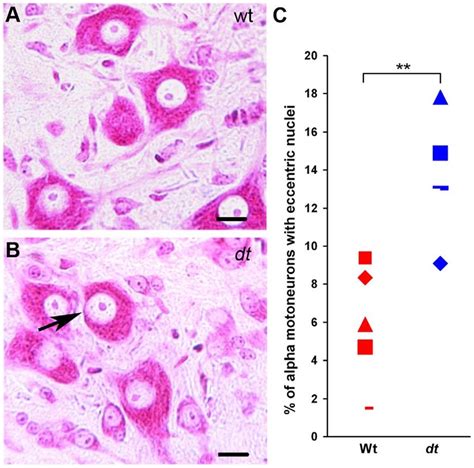 Increase in the number of eccentric alpha motor neuron nuclei in dt 27J... | Download Scientific ...