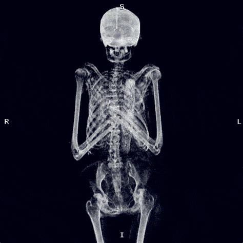 Xrays GIF - Conseguir el mejor gif en GIFER