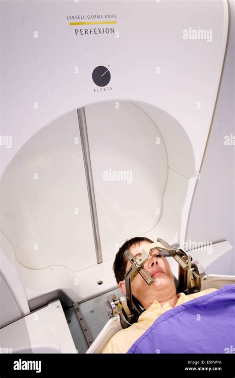 Treatment of a meningioma (benign brain tumor) with a Gamma knife, Here ...