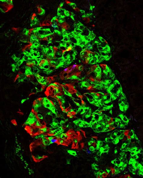 Functional Insulin-Producing Cells Grown In Lab | UC San Francisco