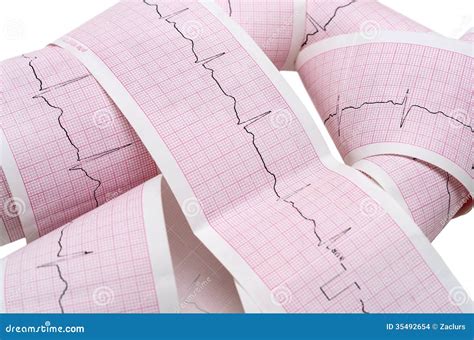 Paper ECG Graph With Heartbeat Pulse Stock Photo - Image of cardiological, cardiovascular: 35492654