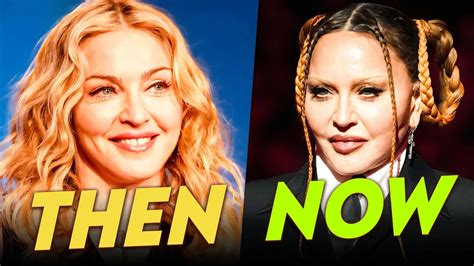 Madonna | Before & After | Plastic Surgery Transformation