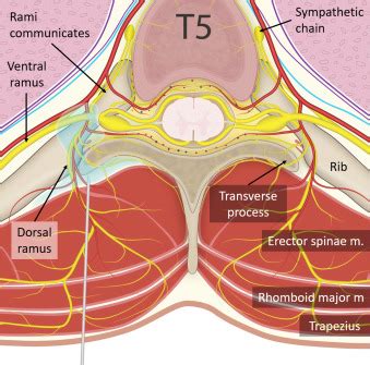 Continuous Erector Spinae Plane (ESP) Block for Postoperative Analgesia ...