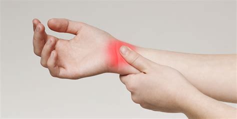 What To Know About Carpal Tunnel Syndrome