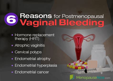 6 Causes of Vaginal Bleeding after Menopause | Menopause Now