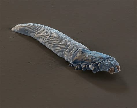 Demodex Folliculorum Sem Photograph by Meckes/ottawa - Fine Art America