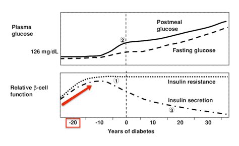 The C-Peptide Test – The Most Important Blood Test for Diabetes