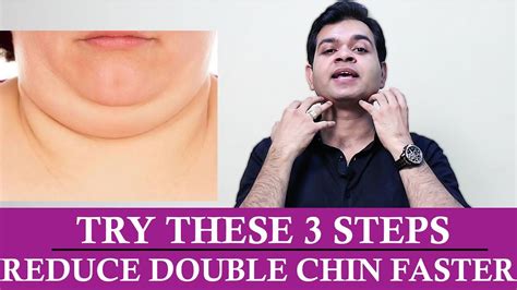 Best Exercises To Remove DOUBLE CHIN Quickly- How Double Chin Can Be Reduced Permanently-TRY ...