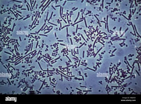 Bacteria taken from Human Mouth, LM Stock Photo - Alamy