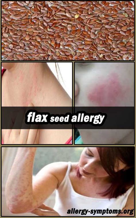 Flax Seed Allergy Symptoms and Diagnosis - Allergy Symptoms