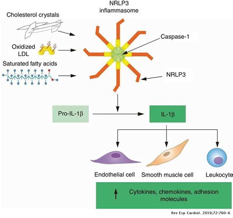 Potential Therapeutic Value of Interleukin 1b-targeted Strategies in Atherosclerotic ...