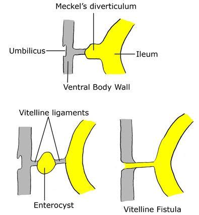 vitelline duct - Google Search | Step 2 Maloooooo in 2018 | Pinterest ...