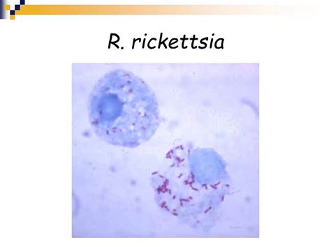 Part2 Rickettsia - YouTube