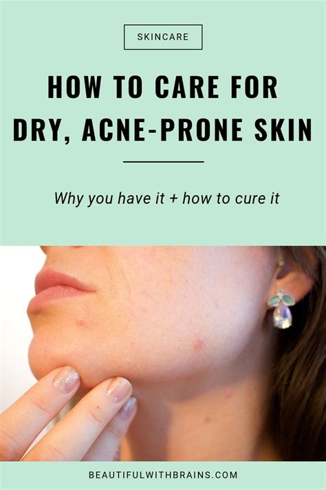 How to deal with acne and dry skin