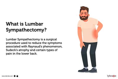 Lumbar Sympathectomy: Purpose, Procedure, Benefits and Side Effects