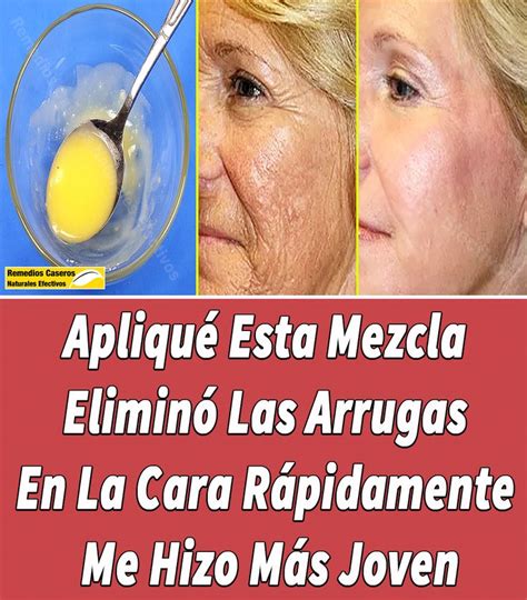 Como Eliminar Las Arrugas De Las Manos Arrugas En La Cara Arrugas | The ...