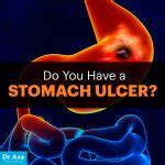 Stomach Ulcer Symptoms and How To Heal - The Homestead Survival