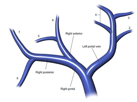 Pin on Cross-sectional liver imaging