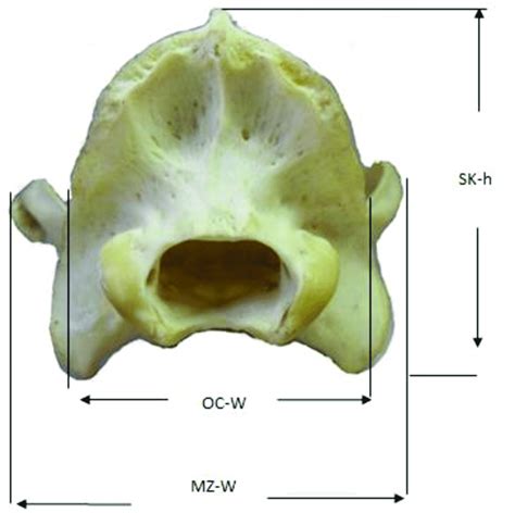 Caudal view of the skull of adult N. Procyonoides showing the following... | Download Scientific ...