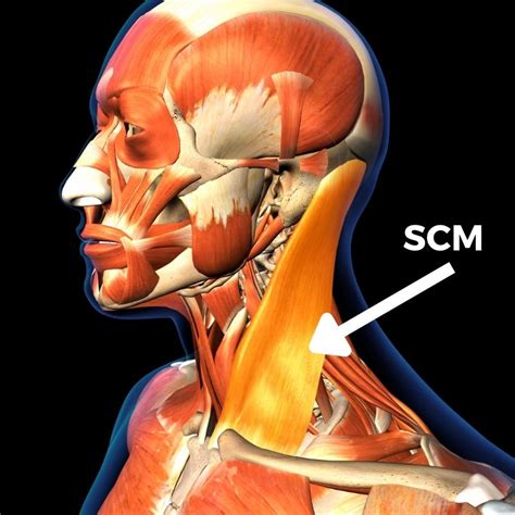 All About the Sternocleidomastoid Muscle: Anatomy and Treatment