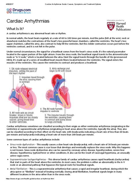 Cardiac Arrhythmias Guide_ Causes, Symptoms and Treatment Options ...