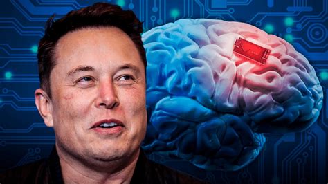 Neuralink, de Elon Musk, ya puede implantar chips en cerebros humanos - MDZ Online