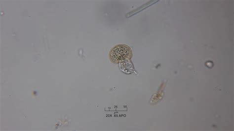 Pond Life Through the Microscope: Arcella 3 TL Reproduction - YouTube