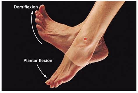 Siempre Contemporáneo oportunidad fascitis plantar neuroma de morton ...