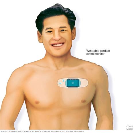 Electrocardiogram (ECG or EKG) - Mayo Clinic