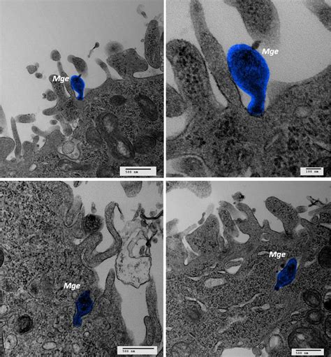 Mycoplasma genitalium's cell adhesion mechanism revealed