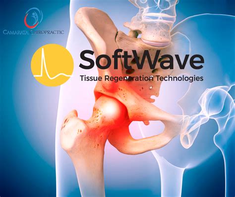 Understanding Hip Pain: Arthritis vs. Bursitis and How SoftWave Therapy ...