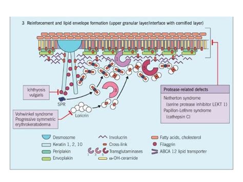 Skin Keratinization & Its Disorders