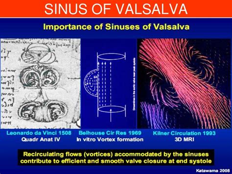 SINUS OF VALSALVA ANEURYSM