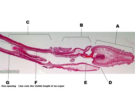 Acorn Worm Anatomy Quiz