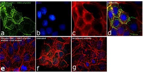 Phospho-ERK1/ERK2 (Tyr204) Antibody (PA5-36776)