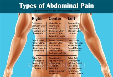 17 best Abdominal Pain images on Pinterest | Abdominal pain, Nursing and Human anatomy