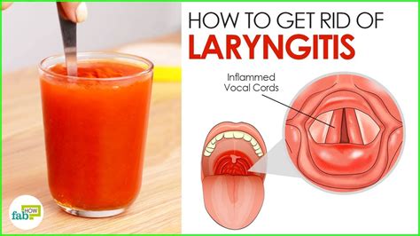 Laryngitis Home Remedies: 3 Most Powerful Cures - YouTube