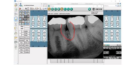 Software DEXIS™ Imaging Suite | DEXIS