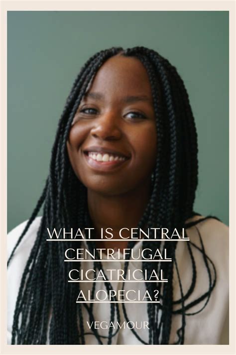 What Is Central Centrifugal Cicatricial Alopecia? | Hair growth foods, Dry scalp, Alopecia