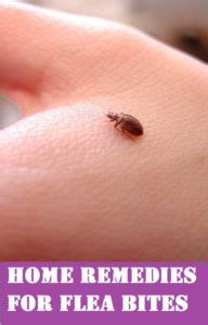 How to Treat Flea Bites in Humans; 7 Tried & Tested Home Remedies