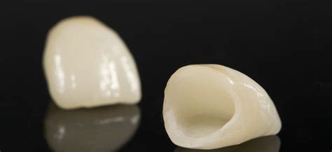 Dental Crowns | Benefits, Procedure Details & Cost Info