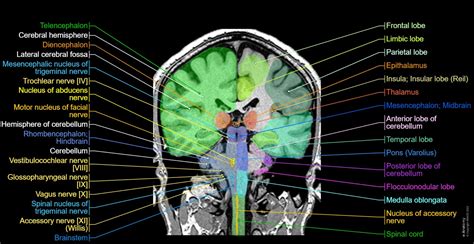 Cerebellum Anatomy Mri