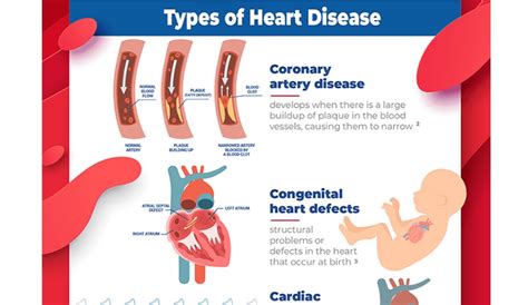 Infographic: Types And Causes Of Heart Disease | Boomers Daily