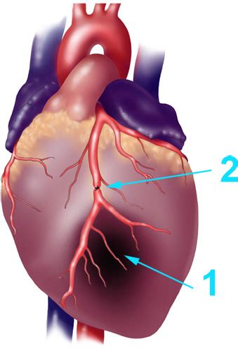 Acute Myocardial Infarction in Rats | Protocol