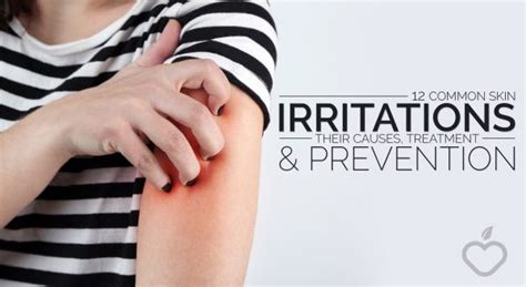 12 Common Skin Irritations: Their Causes, Treatment and Prevention ...