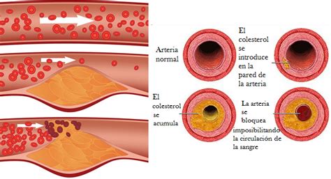 Colesterol bueno o HDL y malo o LDL, triglicéridos y niveles normales