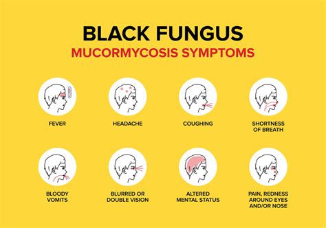 What is black fungus ? - Nayanam Opticals & Eye Clinic