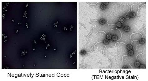 Negative Staining- Principle, Reagents, Procedure and Result