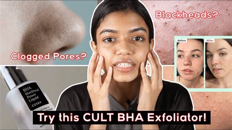 Cosrx BHA Blackhead Power Liquid REVIEW India - How To Use, Sensitive Skin, Blackhead Removal # ...